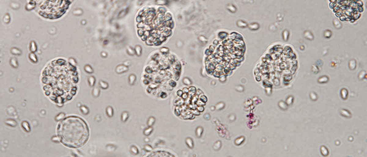 Permalink to: Posters