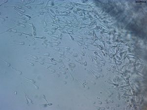 mixosporidios mesenterio-0006